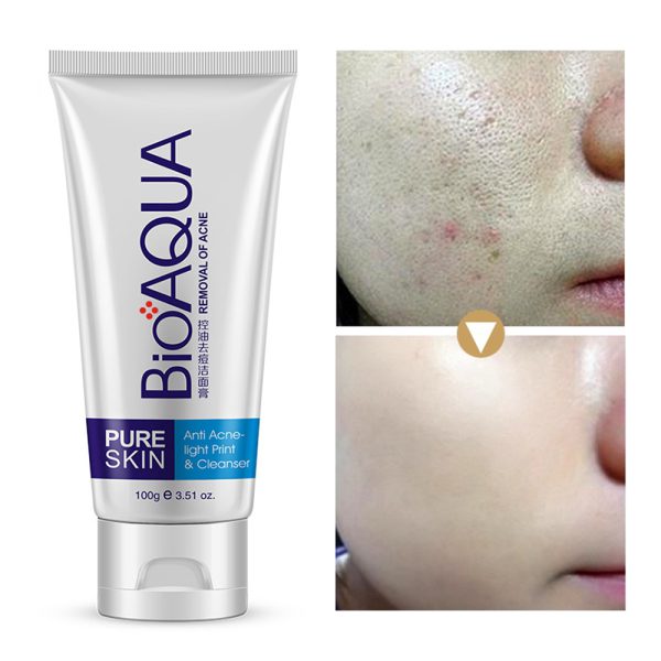 Bioaqua Skin Care Acne Face Removal Cleanser